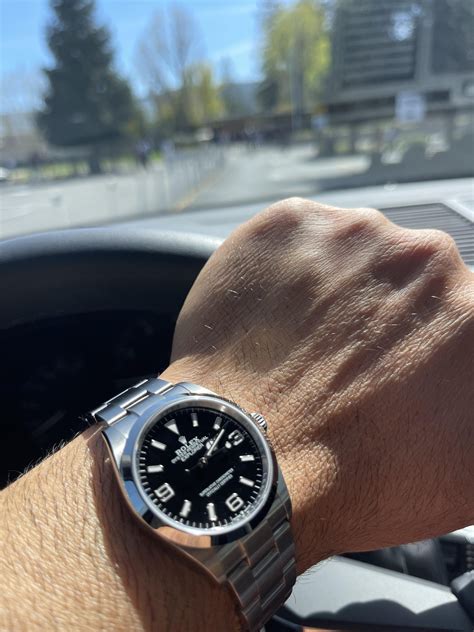 124270 on wrist